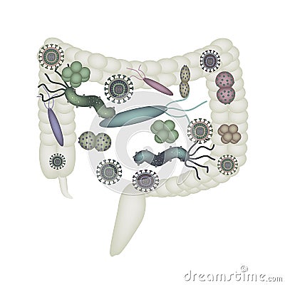 Dysbacteriosis of the intestine. Colon. dysbiosis of colon. Bacteria, fungi, viruses. Infographics. Vector Illustration