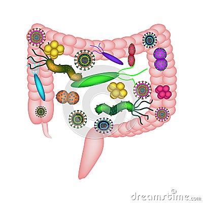 Dysbacteriosis of the intestine. Colon. dysbiosis of colon. Bacteria, fungi, viruses. Infographics. Vector Illustration