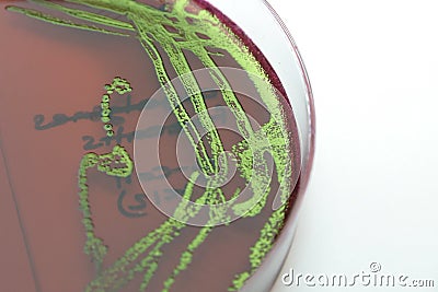E. coli on EMB agar Stock Photo