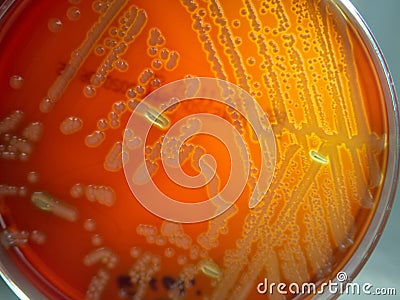 E. coli With Hemolysis on Blood Agar Stock Photo