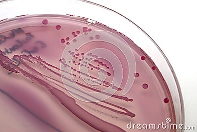 E. coli on MacConkey agar Stock Photo