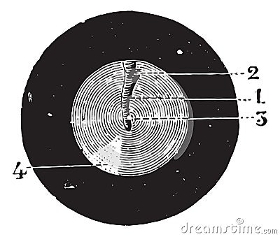 Eardrum left ear, vintage engraving Vector Illustration