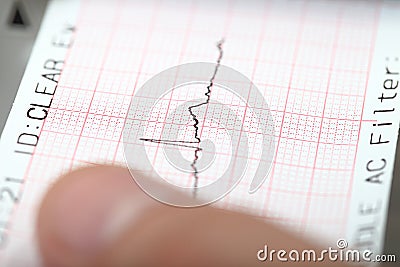 Earthquake on a seismograph. Stock Photo