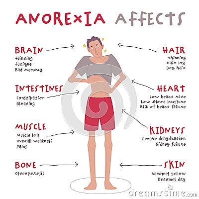 Eating disorder in men and boys. Anorexia nervosa. Vector Illustration