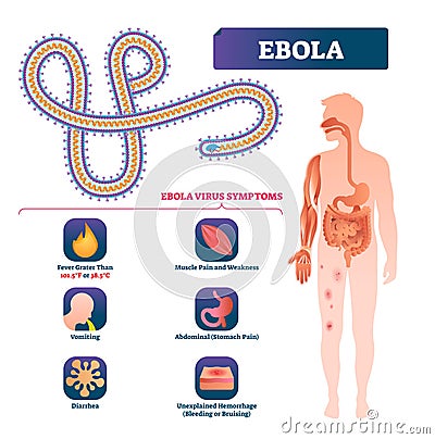 Ebola vector illustration. Labeled virus bacteria infection symptoms scheme Vector Illustration