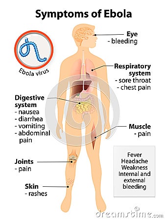 Ebola virus disease Vector Illustration