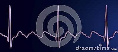 ECG in atrial flutter, 3D illustration Cartoon Illustration