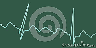 ECG in atrial flutter, 3D illustration Cartoon Illustration