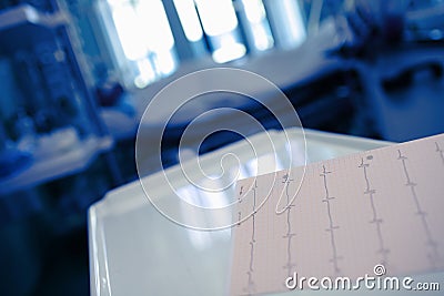 ECG chart on the desktor in the patient`s room at the night Stock Photo