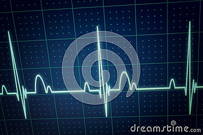 ECG / EKG monitor Stock Photo