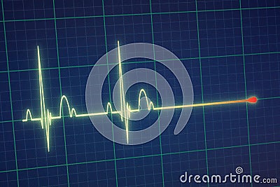 ECG / EKG monitor Stock Photo