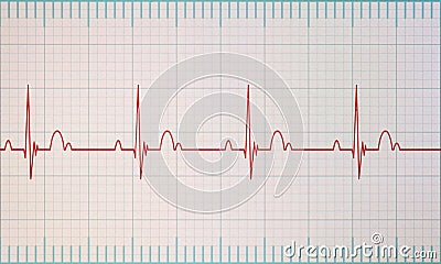 ECG / EKG monitor Stock Photo