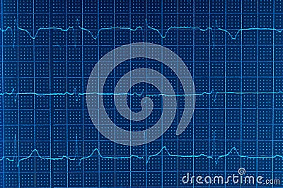 ECG Electrocardiogram Stock Photo