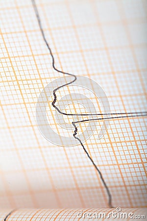 ECG graph as a concept heart conditions diagnosis Stock Photo