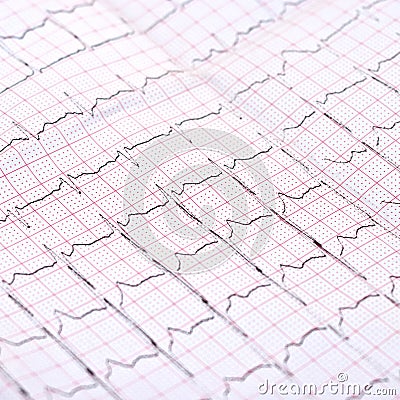 ECG printout Stock Photo