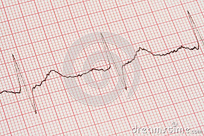 ECG printout Stock Photo