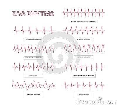 Ecg templates. Medical infographic lines heart arrhythmia health conceptual pictures for doctors info garish vector ecg Vector Illustration