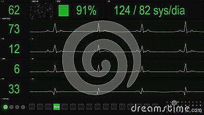 ECG testing software User Interface Stock Photo