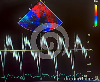 Echocardiogram colorful probe targeting map and waveforms Stock Photo