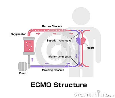 ECMO Extracorporeal membrane oxygenation structure vector illustration Vector Illustration