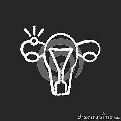 Ectopic pregnancy chalk white icon on black background Vector Illustration