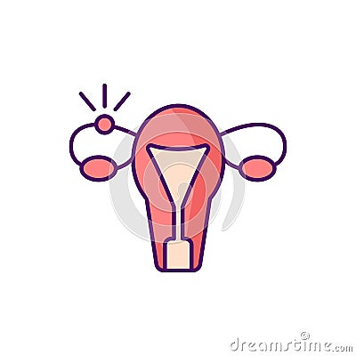 Ectopic pregnancy RGB color icon Vector Illustration