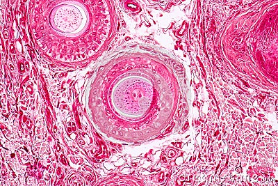 Histological sample Elastic cartilage Tisue under the microscope. Stock Photo