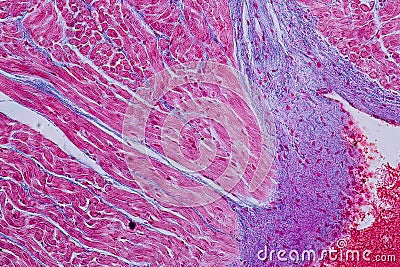 Histological sample Heart muscle Tissue under the microscope. Stock Photo