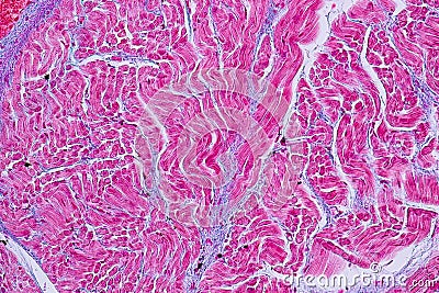 Histological sample Heart muscle Tissue under the microscope. Stock Photo