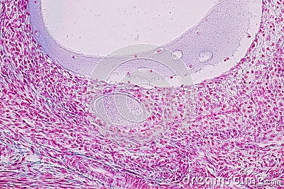 Histological sample Ovary of rabbit Tissue under the microscope. Stock Photo