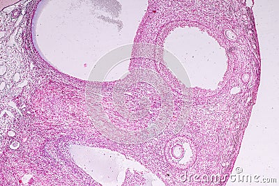 Histological sample Ovary of rabbit Tissue under the microscope. Stock Photo
