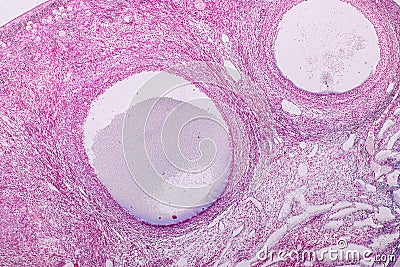 Histological sample Ovary of rabbit Tissue under the microscope. Stock Photo