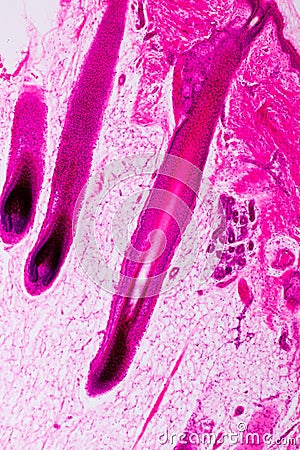 Education anatomy and physiology of Human scalp show of hair folticles under the microscopic. Stock Photo