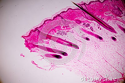 Education anatomy and physiology of Human scalp show of hair folticles under the microscopic. Stock Photo