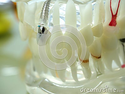 Education human dental model, transparent demonstration of teeth implantation and nerves, on a table close up Stock Photo