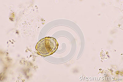 Egg of Ascaris lumbricoides in human stool Stock Photo