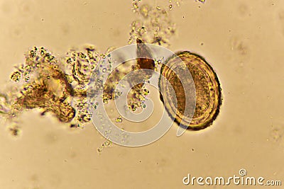 Egg of Ascaris lumbricoides roundworm in human stool Stock Photo