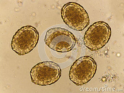 Egg of Ascaris lumbricoides roundworm in human stool Stock Photo