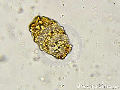 Egg of Ascaris lumbricoides (roundworm) Stock Photo