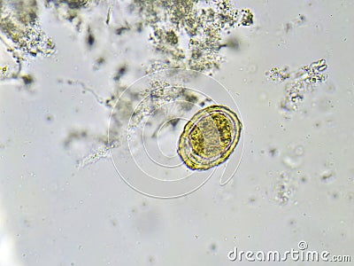 Egg of Ascaris lumbricoides roundworm Stock Photo