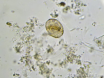 Egg of Ascaris lumbricoides roundworm Stock Photo