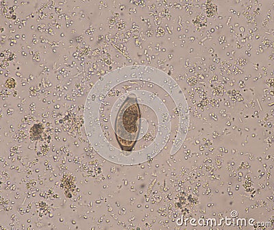 Egg parasite in stool exam Stock Photo