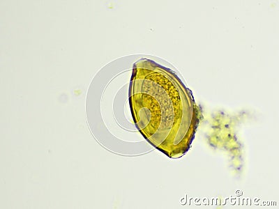 Egg of Trichuris trichiura in human stool Stock Photo