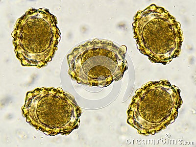 Eggs of Ascaris lumbricoides (roundworm) Stock Photo