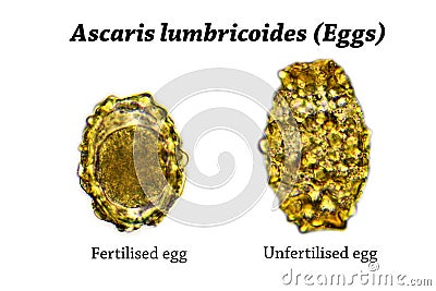 Eggs of Ascaris lumbricoides (roundworm) Stock Photo