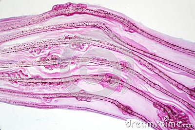 Eggs liver flukeParasitic flatworm infection in fish fin. Stock Photo