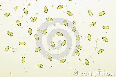 Eggs of Opisthorchis viverrini or Southeast Asian liver fluke in stool Stock Photo