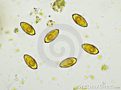 Eggs of Opisthorchis viverrini or Southeast Asian liver fluke in stool Stock Photo