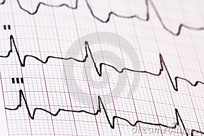 Ekg/ ecg as a background Stock Photo