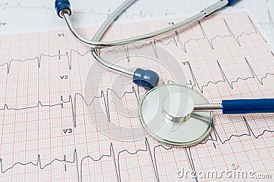 EKG / ECG chart and stethoscope Stock Photo